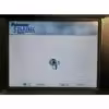 Palomar StarLux LuxV Handpiece 300/500 Lux V Acne Pigmented Lesions 1520-V016