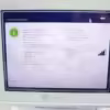 2023 Lumenis OptiLight Non-Invasive Pulse Technology Dry Eye Relief System