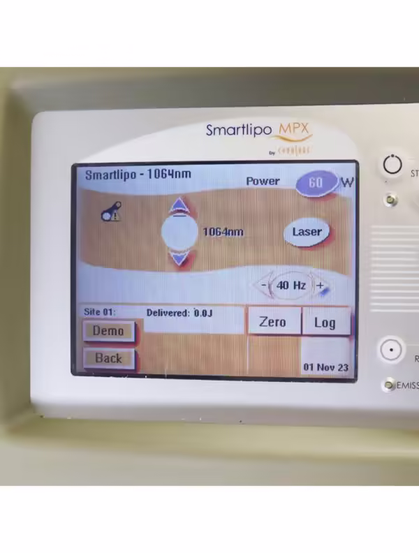 2015 Cynosure Smartlipo MPX 1064 1320 Nd YAG Laser Body Sculpting Non-RFID