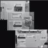 2010 Zeltiq CoolSculpting Body Contouring Cryolipolysis System