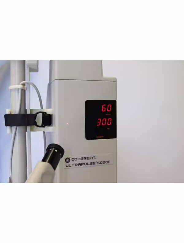 1994 Coherent UltraPulse 5000C Ultra Pulse 60W CO2 Laser+ CPG Fractional Scanner