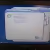 2005 Lumenis 1 Lume One Nd:YAG Universal IPL RF Hair Removal Laser System