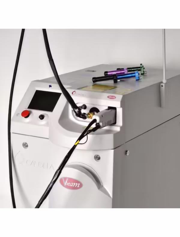 2003 Candela VBeam Wrinkles Scars Acne Stretch Marks Pulsed Dye Laser System