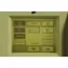 2002 Candela VBeam V Beam 1 Pulsed Dye 595 nm Vascular Acne Laser NEW DYE KIT