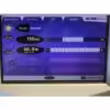 2009 Lumenis UltraPulse SurgiTouch Ultra Pulse 60W 225mJ CO2 Laser Encore DeepFX