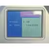 2006 Syneron Candela eLaser 810 Diode Laser Hair Removal DSL Handpiece HR